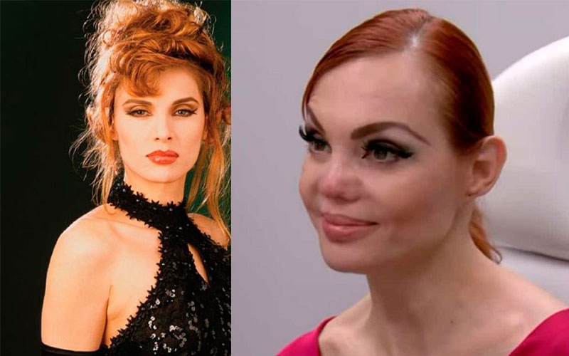 Carmen Campuzano desea recuperar su nariz en reality de EUA